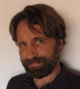 Picture of me with COVID beard